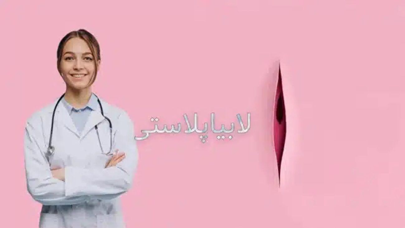 عمل لابیاپلاستی